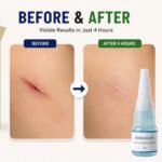 Liquid Bandage Skin Adhesive for Cuts & Wounds – Waterproof Flexible Protection - Image 7